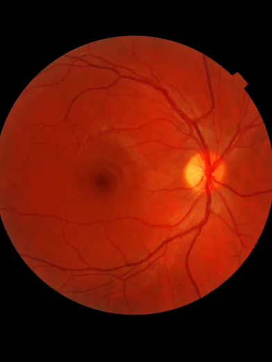 Imagery of a retina scan